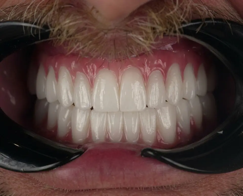 Smile after treatment