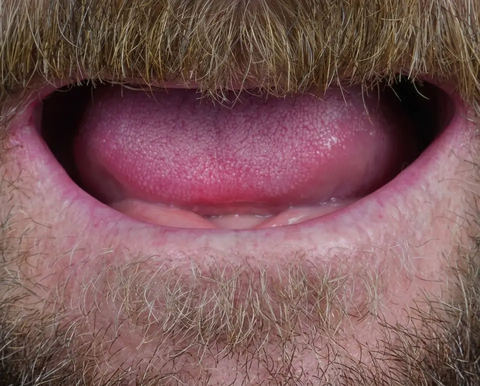 Smile before treatment